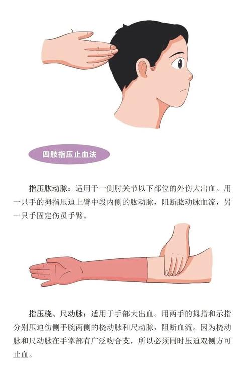 严重出血的止血方法首选加压包扎（严重出血的止血方法是）